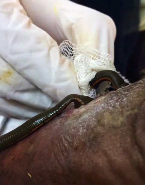 Leeches with arched backs sucking on patient