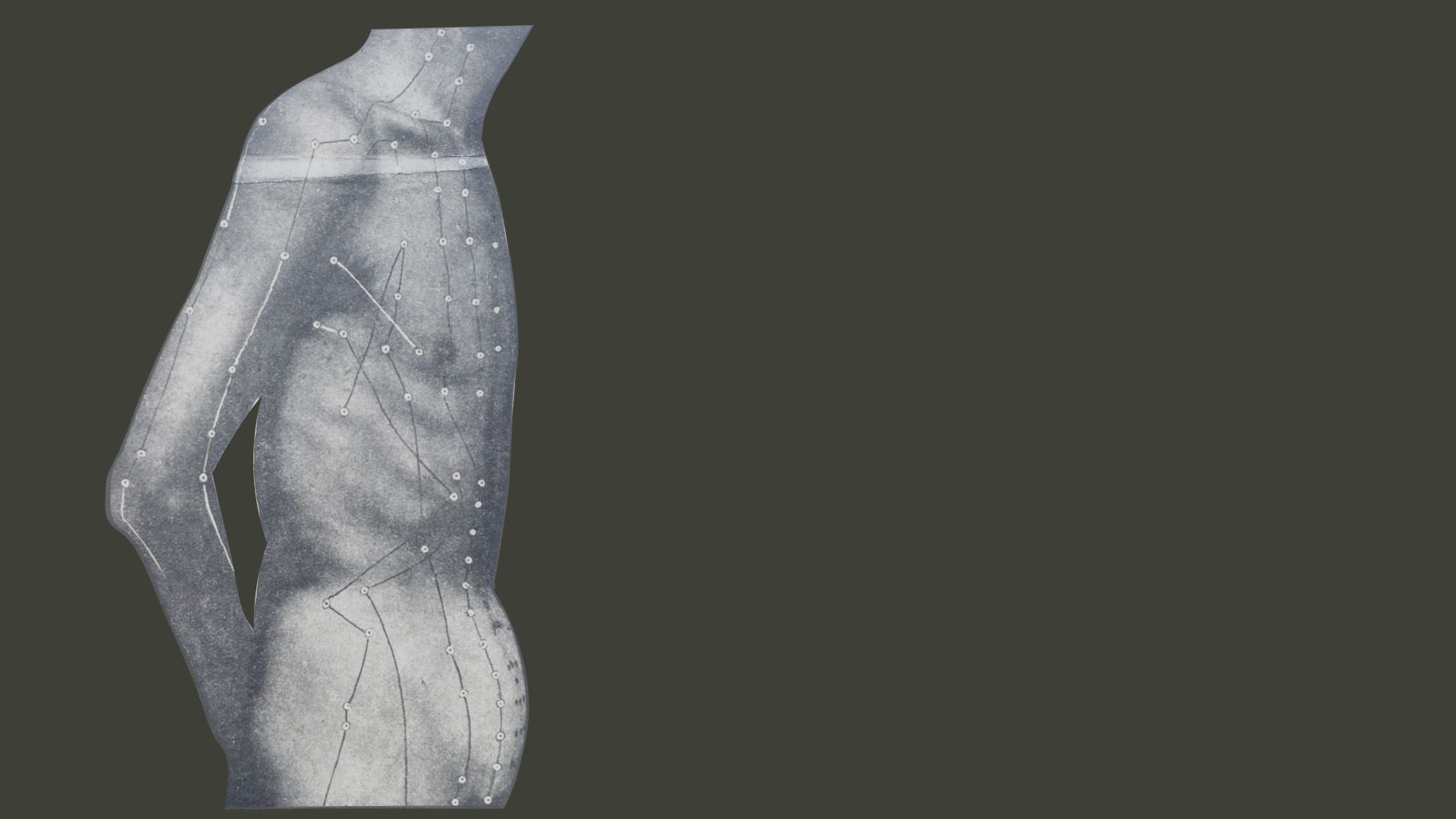 man viewed from side with acupuncture points mapped
