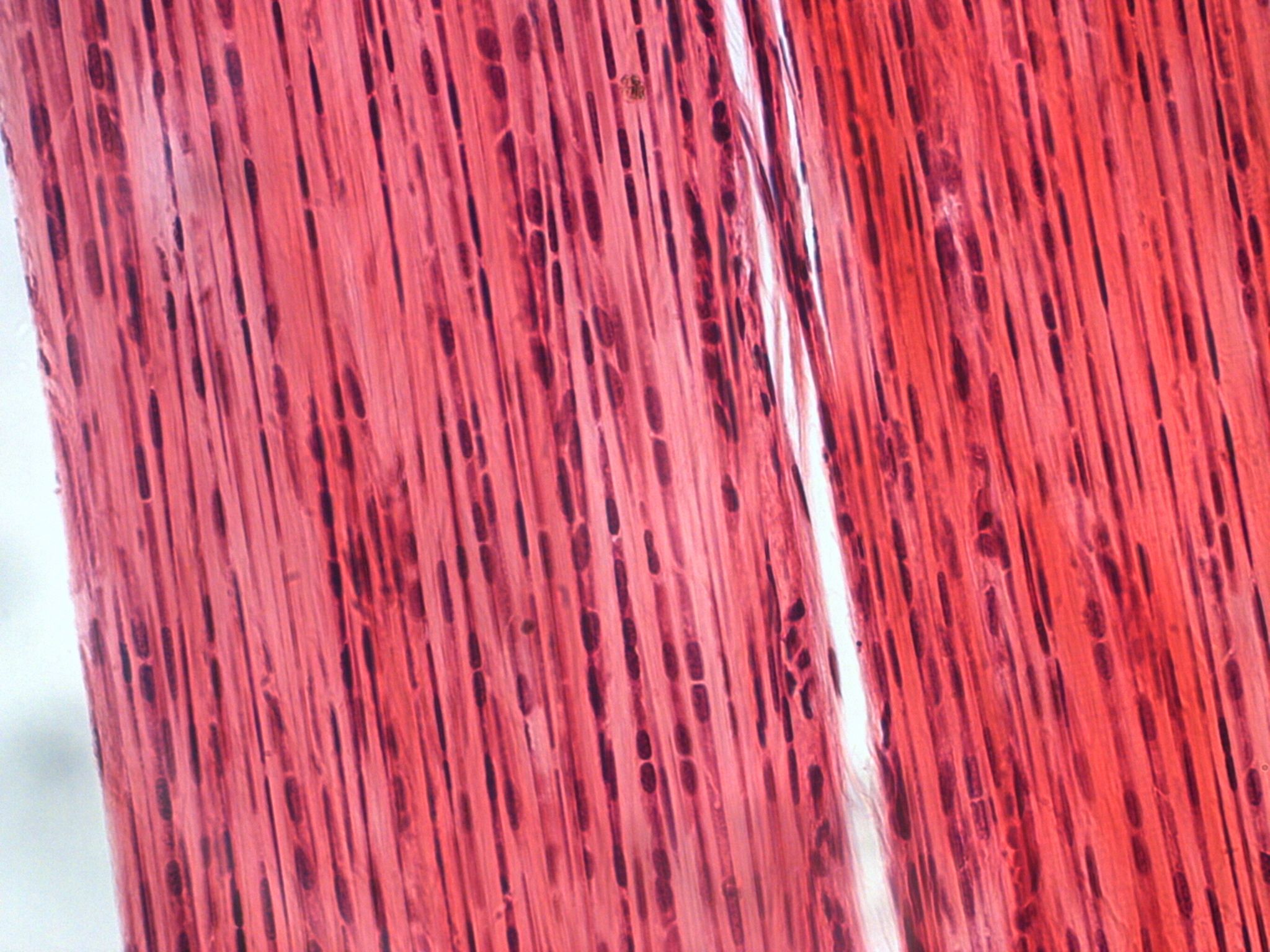 close up of tissue